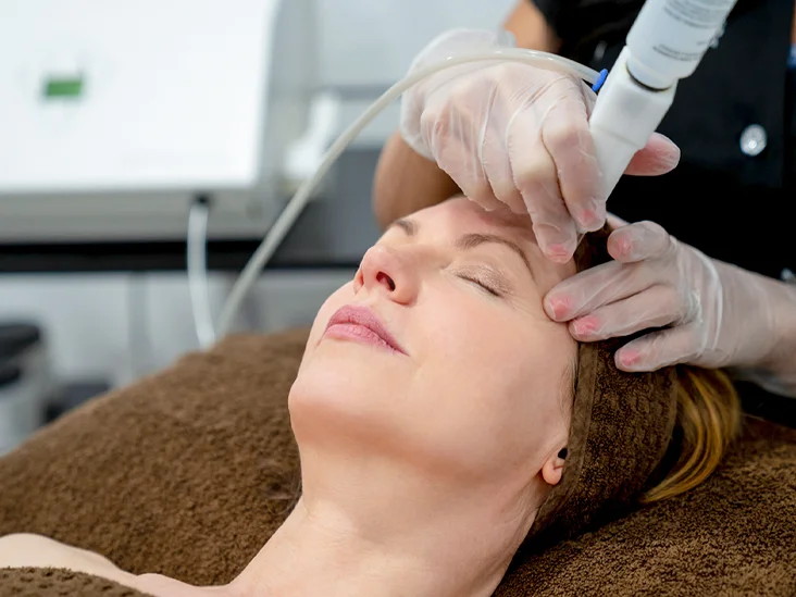 the-benefits-of-cosmetic-laser-treatments